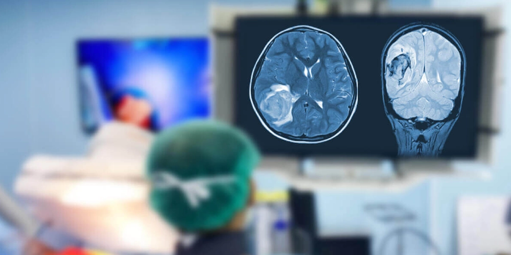 brain tumor surgery beyin tumoru ameliyati